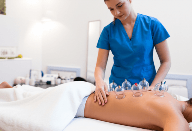 Cupping Therapy